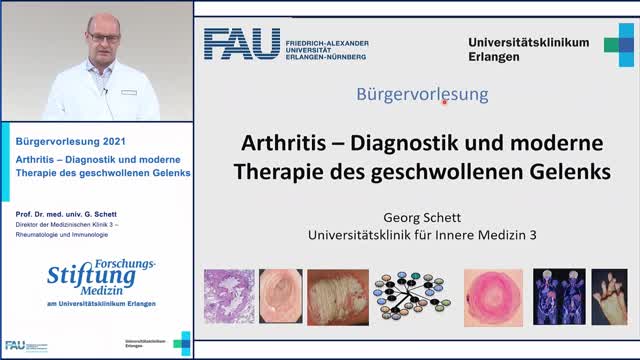 Arthritis - Diagnostik und moderne Therapie des geschwollenen Gelenks preview image