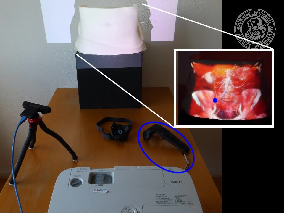 Projection Mapping for In-Situ Surgery Planning by the Example of DIEP Flap Breast Reconstruction preview image