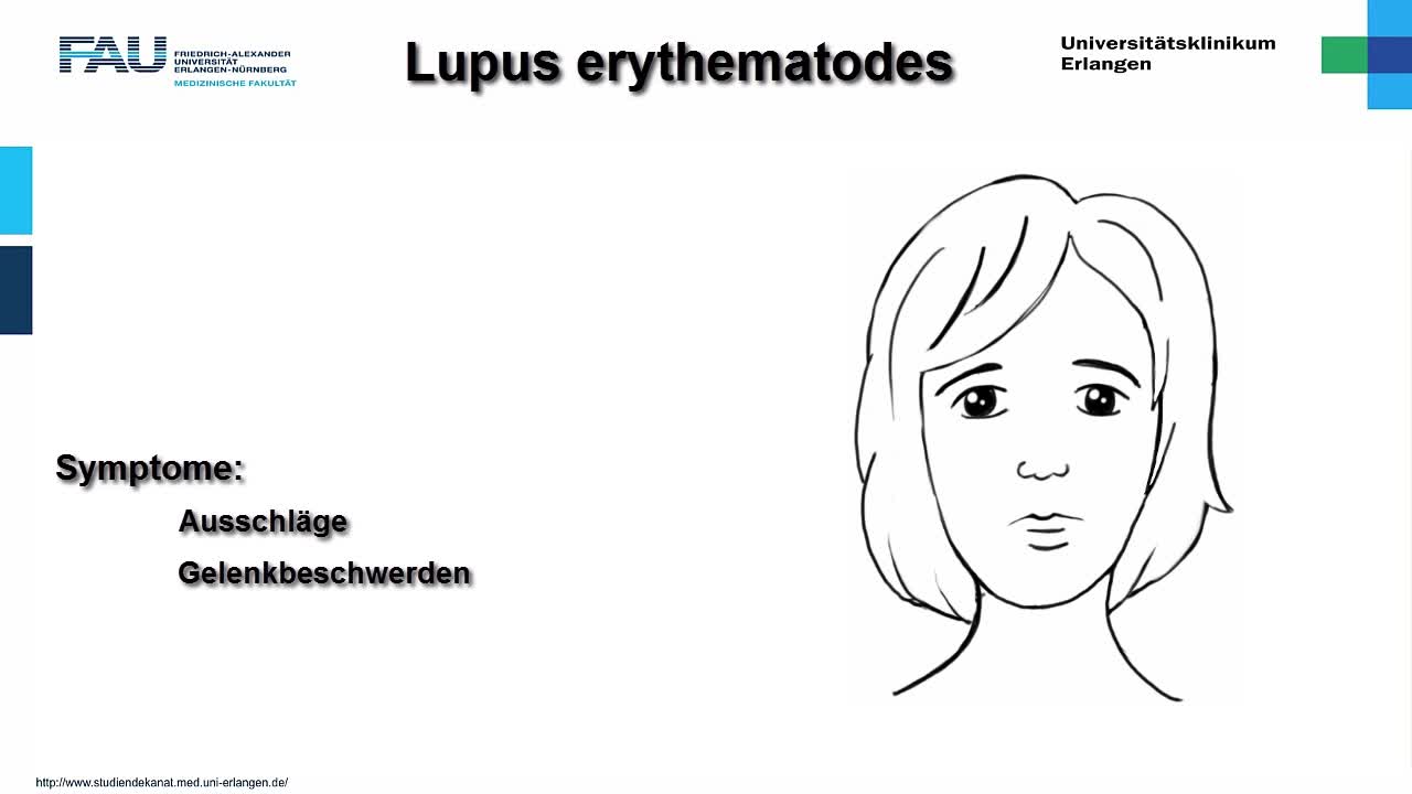 Medcast - Innere Medizin - Lupus erythematodes preview image