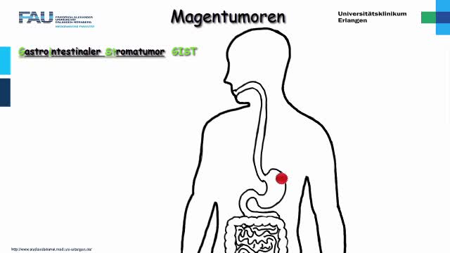 Medcast - Pathologie - Magentumoren preview image